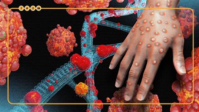 أمريكا تعتزم إنهاء حالة الطوارئ الخاصة بجدري القرود.. ما سر القرار