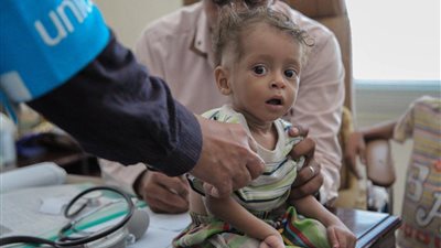 الصليب الأحمر: مليون مصاب بالكوليرا في اليمن