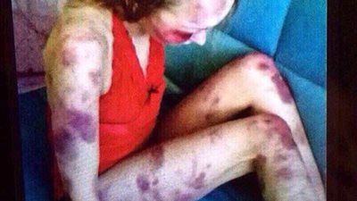 رجل يضرب زوجته حتى الموت ويتباهى بنشر الصور لأصدقائه (صور)