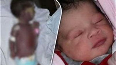 تحقيقات موسعة في تفحم رضيع داخل حضانة بمستشفي الوراق