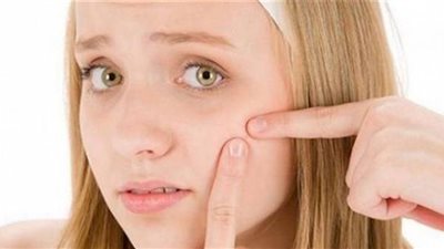 5 طرق طبية للتعامل مع «حب الشباب»