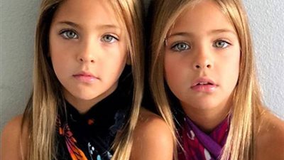 توءم متطابق يحصد لقب أجمل فتيات العالم (صور)