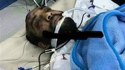 أول صورة للإرهابي منفذ هجوم حلوان من داخل العناية المركزة