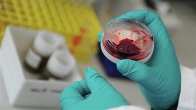 الاشتباه في إصابة سيدة بفيروس كورونا في كفر الشيخ