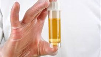 جهاز دقيق يكشف الأورام عن طريق البول