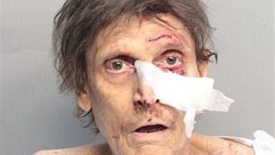 أغرب صور مجرمين يعانون إصابات بالوجه