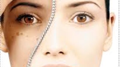 قناع المر والطحينة يقضي على البقع الداكنة بالبشرة