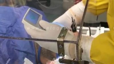 صناديق شفافة ومناظير حنجرية.. ابتكار أوروبي بـ