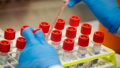 بريطانيا: الإصابات بكورونا تواصل الارتفاع وحصد المزيد من الضحايا