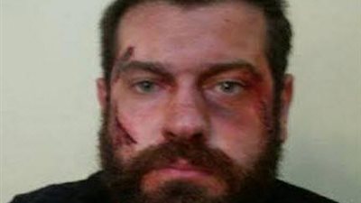 ننشر أول صورة للفنان 