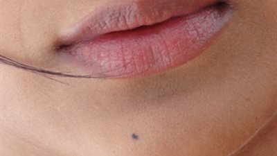 بالفيديو..تعرفي على أسباب اسمرار الشفاة وطريقة علاجها