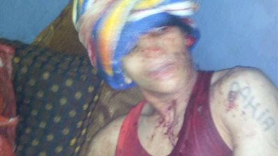 النيابة تعاين حجز قسم كرداسة عقب إصابة 15 متهما في مشاجرة بين المحبوسين