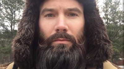 شاب أصلع يشعل «فيس بوك» بلحيته الطويلة الناعمة (صور)