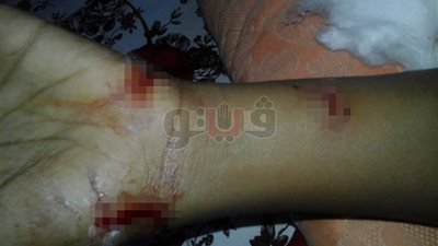 الكلاب المسعورة تهدد أهالي سفاجا في البحر الأحمر (صور)