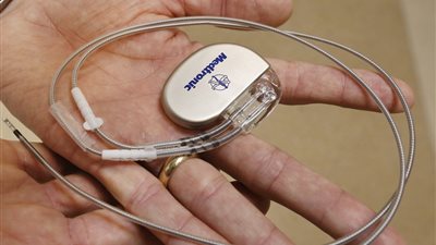 اختفاء الـ«Pacemaker» يهدد قلوب أطفال المحروسة.. التأمين الصحي يتهرب من المسئولية بقرارات صورية.. تكلفة العملية تصل لـ 50 ألف جنيه.. وشركتان أمريكيتان تتوليان توريد الأجهزة للسوق