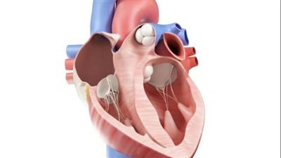 أهم أنواع جراحات عيوب القلب الخلقية للأطفال 