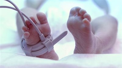 ولادة توأم بفارق 22 يوما، ما القصة 