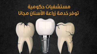 مستشفيات حكومية توفر خدمة زراعة الأسنان مجانا| إنفو جراف 