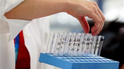 باحث أمريكي يخترع سلالة قاتلة من فيروس إنفلونزا الخنازير