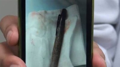 بالصور.. الأطباء يخرجون 