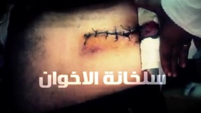 بالفيديو..مصابو موقعة 